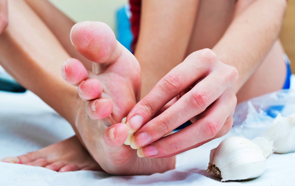 Zázrak, toto se stane, když po chodidle přejedete stroužkem česneku. Neuvěříte, dokud nevyzkoušíte