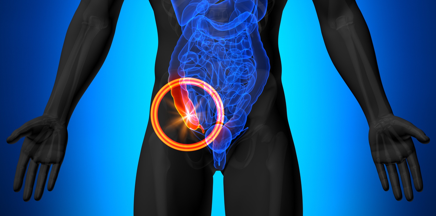 Co kdyby se lidé rodili bez slepého střeva? Evoluční artefakt není tak nepotřebný, jak se může zdát. Má klíčovou úlohu