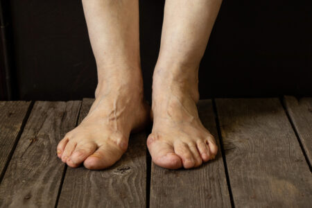 Chodíte často doma naboso? Zpozorněte, vystavujete se bakteriím, zraněním i problémům se zády