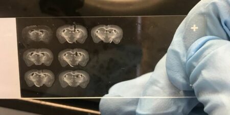 Nadějný výzkum Alzheimerovy choroby na zvířatech. Laboratorní myši mají zodpovědný úkol a vnáší vědcům naději na průlom