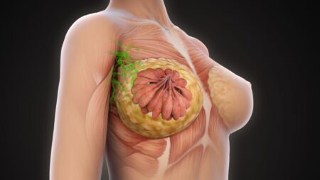 Lék na rakovinu prsu se pomalu stává realitou. Bude aplikován formou očkování