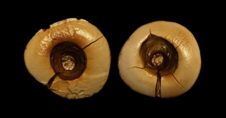 V době kamenné řešili zubní kazy ostrým nástrojem a dehtem. Naznačuje to archeologický nález 2 zachovalých zubů