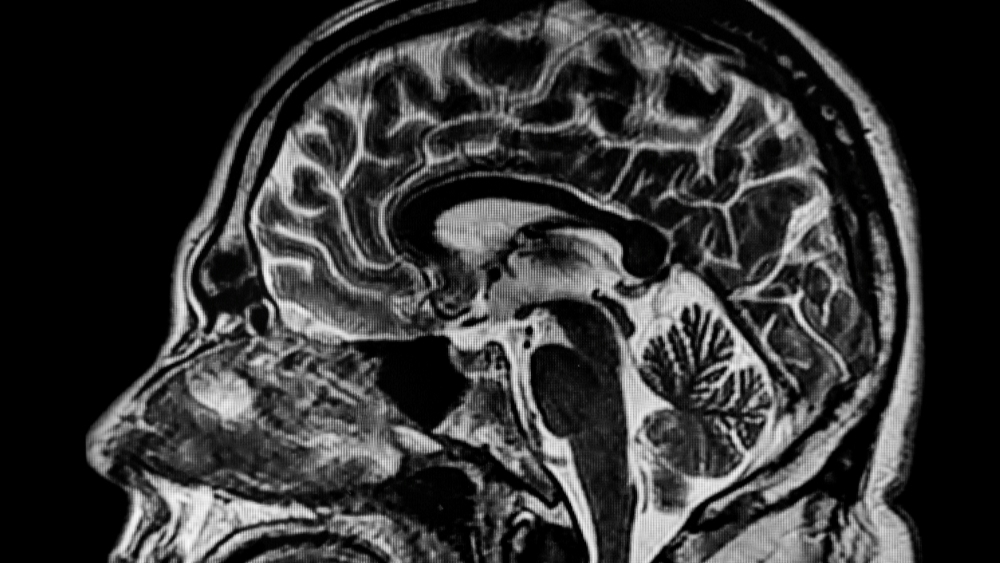 Vůbec první sken umírajícího lidského mozku ukazuje, že se nám opravdu promítá život před očima. Scéna je jako z hollywoodského filmu