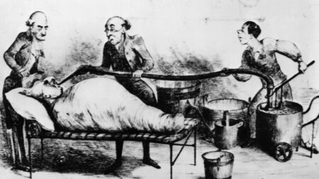 4 děsivé lékařské procedury, na které už se naštěstí zapomnělo. Třeba problém s erekcí se řešíval transplantací zvířecích varlat