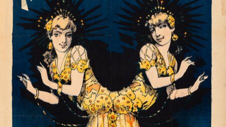 Česká siamská dvojčata dokázala na svém postižení úspěšně vydělat. Jedna z dívek dokonce porodila syna