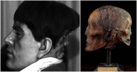 Dvě tváře – jeden plnohodnotný muž a na týlu zakrslé „ďábelské dvojče“. Za městskou legendou se skrývá děsivá pravda