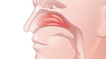 Jestli někdy zadržujete kýchání, ihned přestaňte. Má podstatný účel, a pokud mu nedáte volný průchod, doplatíte na to