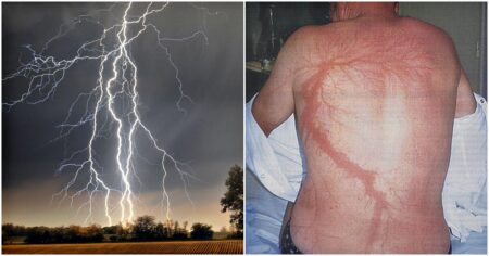 Tento muž tvrdí, že byl 7krát zasažen bleskem a vždy je přežil jen s menší újmou. Nakonec se v 71 letech střelil do hlavy