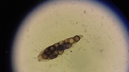 15 zvláštností o lidském těle, které jsou tak trochu nechutné a děsivé zároveň. Věděli jste, že se v řasách nachází roztoči?