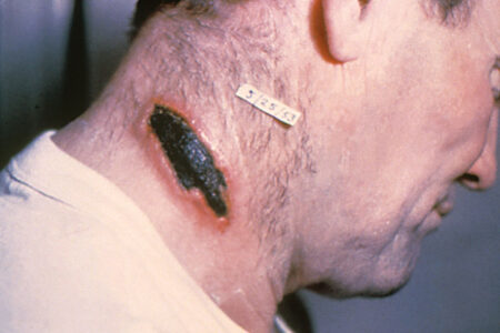 Ty neodpornější zbraně, které kdy kdo vyvinul. S přehledem by zabily půlku populace, ale naštěstí vyhrál zdravý rozum