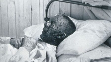 Jak jeden africký otrok zachránil stovky tisíc životů: V roce 1721 měl Onesimus revoluční nápad, jak zastavit epidemii