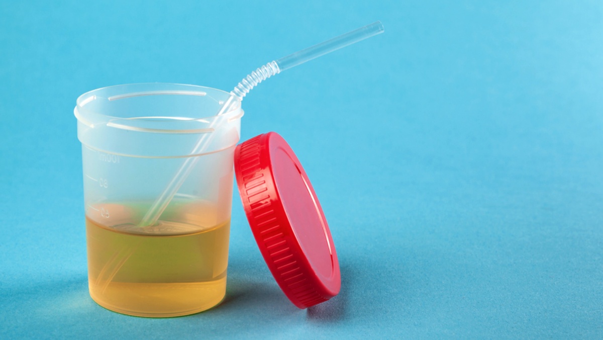 4 podivné věci, které naši předkové léčili močí. V některých případech se kontroverzní metoda používá dodnes