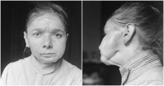 Tváře jim hnily zaživa a některým svítily i ruce. Výroba zápalek má děsivé pozadí, pracovnice továrny zažívaly muka