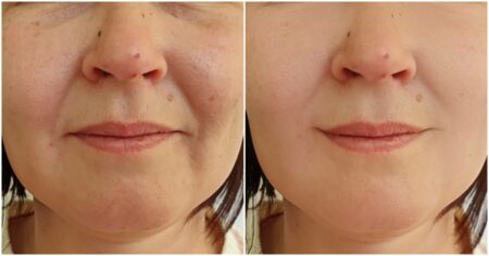 Anna (40 let) provedla experiment se svou pletí: Celý 1 měsíc si nemyla obličej. Byla překvapená, co se s ní stalo