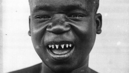 Africký chlapec byl vystaven v zoologické zahradě jako atrakce. Denně se na něj chodilo dívat 40 000 lidí