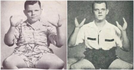 Z „humřího chlapce“ udělali cirkusovou atrakci a za sezónu si vydělal milion korun. Pak začal zabíjet