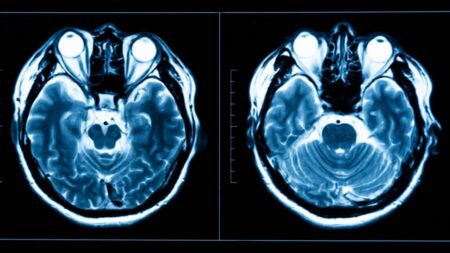 Po úrazu hlavy se u nich vyvinuly nové schopnosti: Jeden dokázal předvídat budoucnost, druhý viděl detaily dávné minulosti