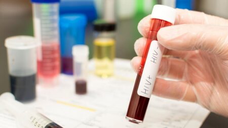 Další pacient byl úspěšně vyléčen z HIV. Díky rizikové terapii, kterou podstoupil před 10 lety