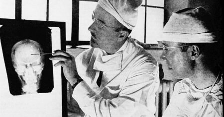Historie „léčby“ lobotomií: Od vrtačky se přešlo k sekáčku na led, místo anestezie pacienta omráčili elektrickým proudem