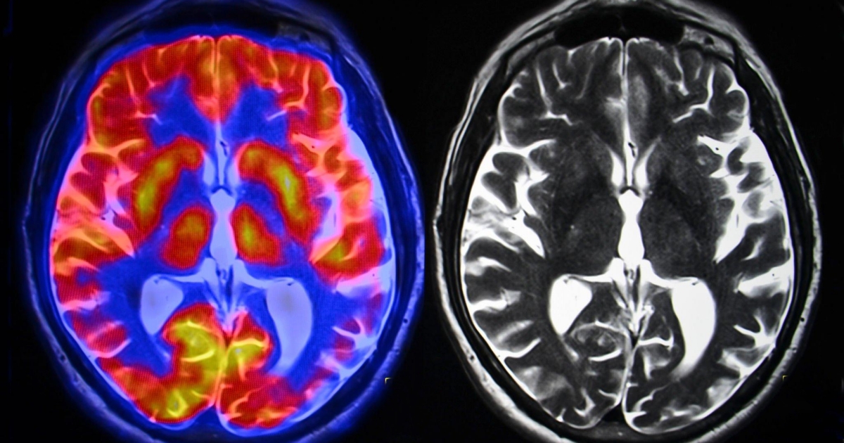 Když nás klame vlastní mozek: Trvá jen pár sekund, než se v něm vytvoří falešné vzpomínky