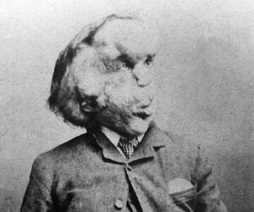 Napůl muž, napůl slon: Joseph Merrick se na veřejnosti snažil schovávat, ale lidé mu nedali pokoj