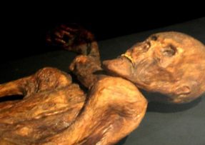 Ötzi