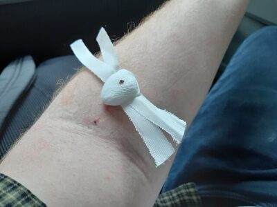 Muž se zlatou paží: James Harrison zjistil, že má vzácnou krev, zachránil tak život 2,4 milionu miminek