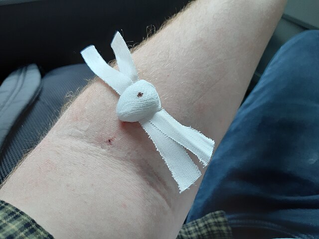 Muž se zlatou paží: James Harrison zjistil, že má vzácnou krev, zachránil tak život 2,4 milionu miminek