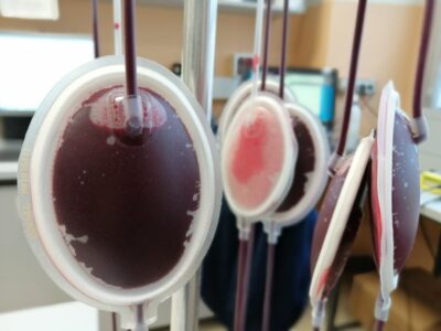 „Zlatou krev“ má méně než 50 lidí na světě. Pro lékaře je ale doslova pokladem