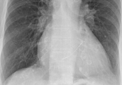 Jak dobře znáte lidský organismus? Některé otázky zvládne každý, plný počet ale oddělí nadprůměr od zbytku