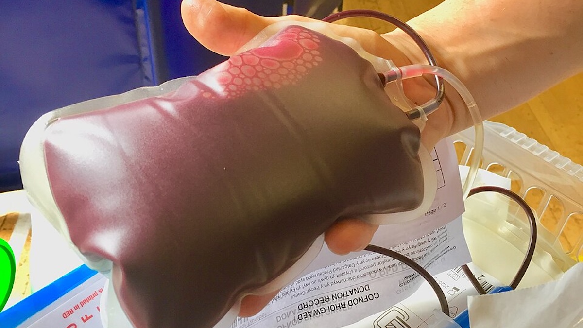 Průlom v medicíně: Japonci vyvinuli krev, kterou může dostat úplně každý