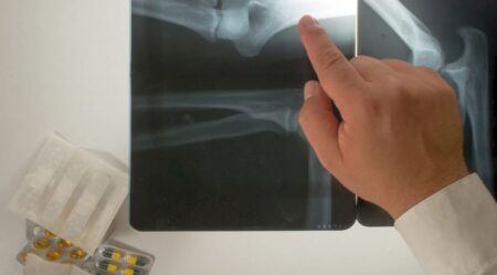 WHO: Do roku 2050 onemocní rakovinou každý pátý člověk na světě. Rozhoduje země, kde se narodíte